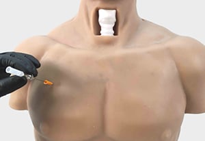 CHEST NEEDLE THORACENTESIS