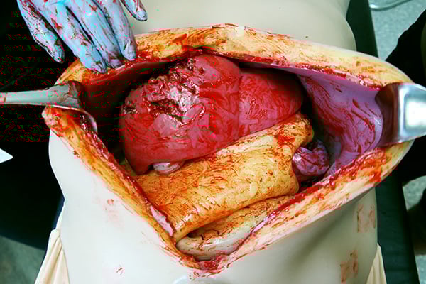 Open Surgical Simulation System