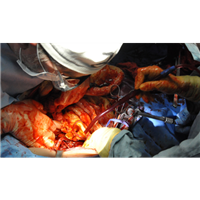 Advanced Surgical Skills Packages (ASSP)